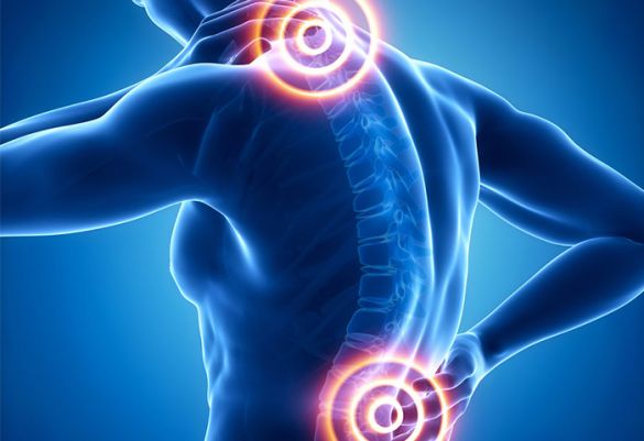Haltungsfehler gelten als Hauptursache für Rücken- und Nackenschmerzen.